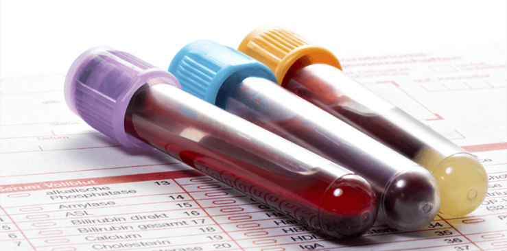 Czy leki wpływają na wynik badania krwi?